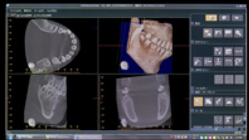 トリニティコア