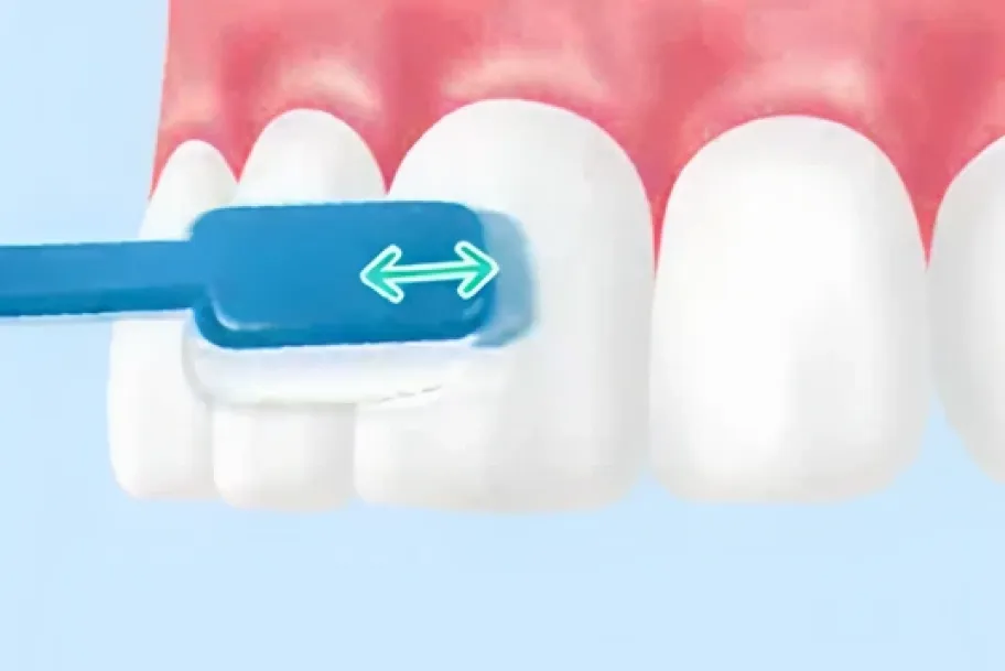 きれいになった歯を維持できるよう、正しいブラッシング方法を指導します。