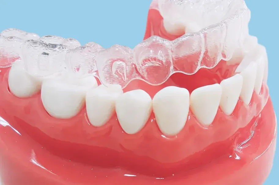 矯正治療（歯並びを直したい）